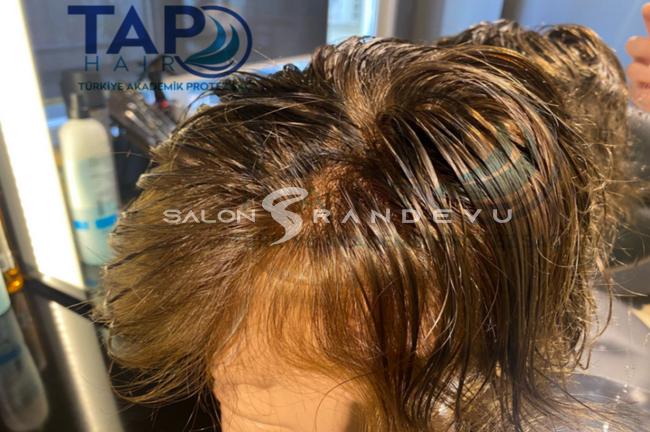 Tap Hair Türkiye Akademik Protez Saç olarak verdiği hizmetin fotoğrafı 5